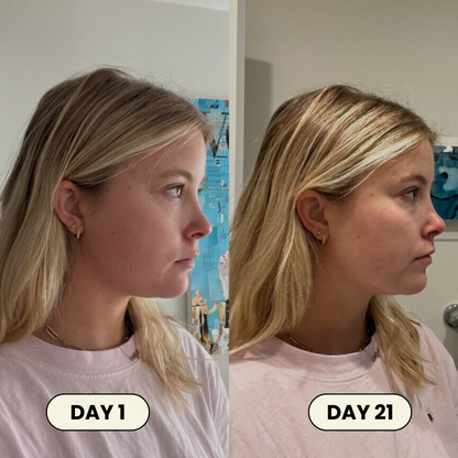 Face Lifting Mask by Healo™