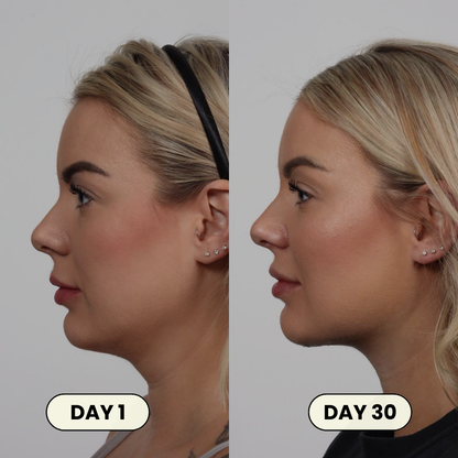 Face Lifting Mask by Healo™