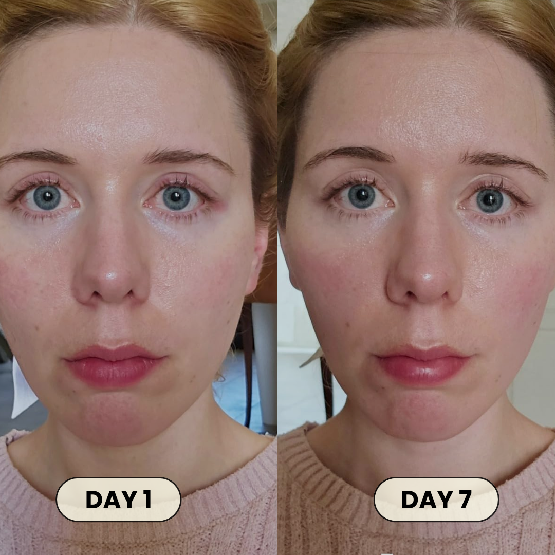 Face Lifting Mask by Healo™
