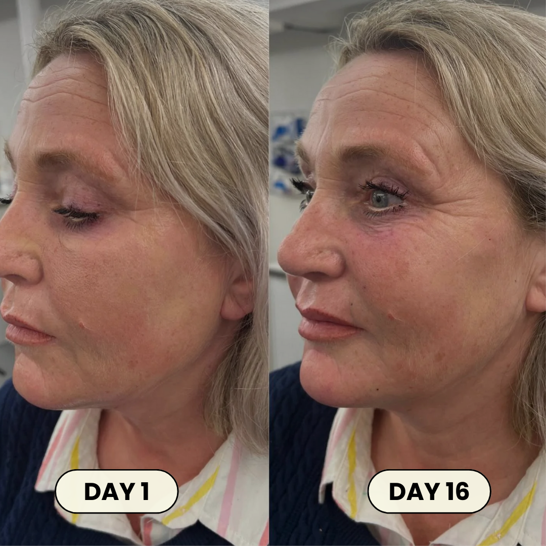 Face Lifting Mask by Healo™